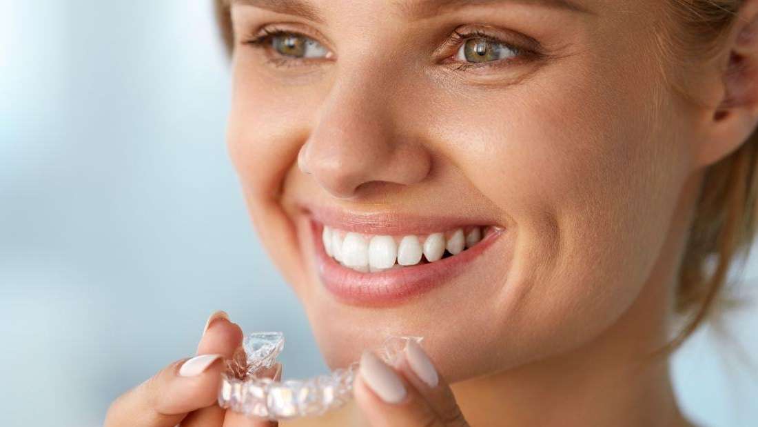 How Does the Invisalign Process Work? Invisalign Fishers IN